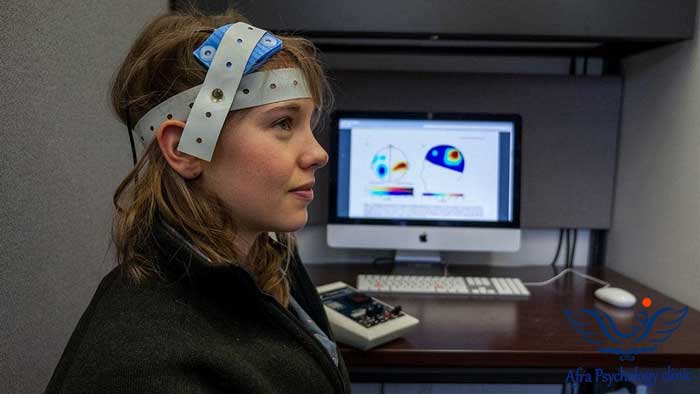 تحریک الکتریکی مغز TDCS